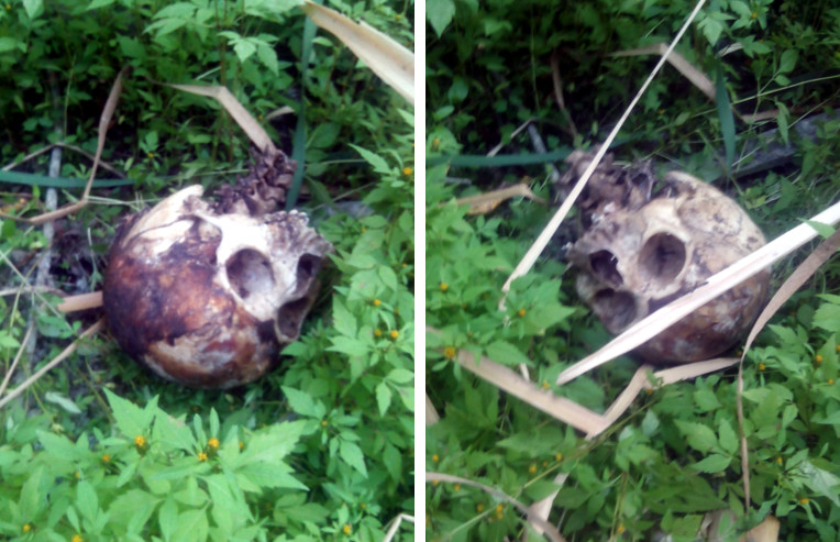 В Сторожинці  дитина знайшла людський череп